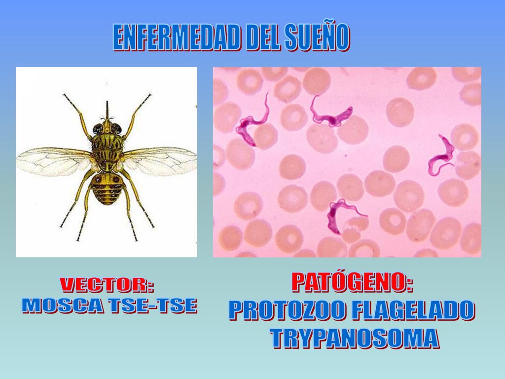 vector de enfermedad del sueño